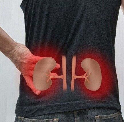 Low pain can occur with pyelonephritis