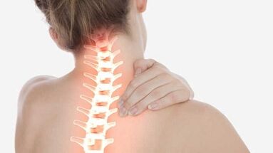 The main manifestations of cervical osteochondosis