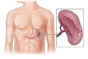 pathology of the spleen as a cause of pain under the left scapula