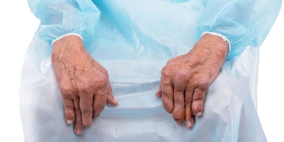 Infectious arthritis is a disease characterized by constant pain and changes in the finger joints.