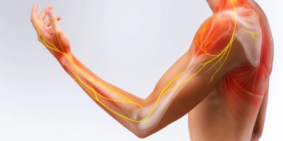 Pain and numbness in the fingers indicate ligament damage from stenosing ligamentitis
